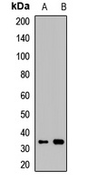Anti-Mimecan Antibody