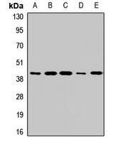 Anti-RAMP3 Antibody