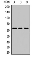 Anti-NPT2 Antibody
