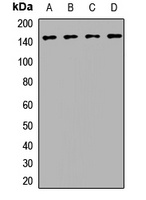 Anti-BRIP1 Antibody