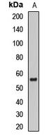 Anti-DGAT1 Antibody