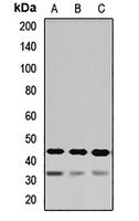 Anti-ASGR1 Antibody