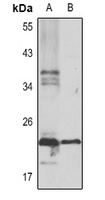 Anti-Serglycin Antibody