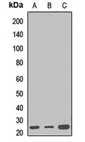 Anti-WRB Antibody