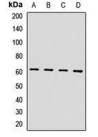 Anti-HIRIP3 Antibody