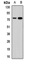 Anti-TRMT2A Antibody