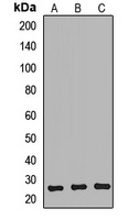 Anti-NTMT1 Antibody