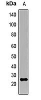 Anti-KCNIP2 Antibody