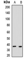 ART5 antibody