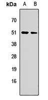 KIAA1456 antibody