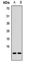 Anti-p53 AIP1 Antibody