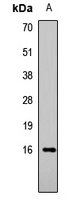 Anti-Histone H3 (Acetyl-K9) Antibody
