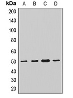 Anti-TMLHE Antibody