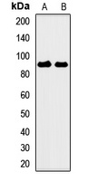 Anti-CSRP2BP Antibody