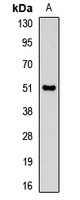 Anti-Pancreatic Lipase Antibody