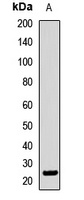 Anti-TEX27 Antibody