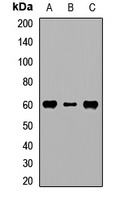 Anti-RPS6KL1 Antibody