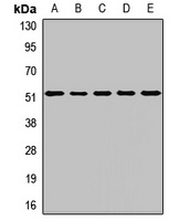 Anti-BRK Antibody