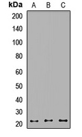 RAB1B antibody