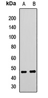 Anti-TARBP2 Antibody