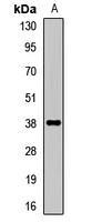 Anti-IFNGR2 Antibody