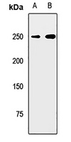 Anti-Myosin 7 Antibody