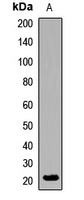 Anti-TLF Antibody