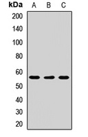 Anti-SGK3 Antibody
