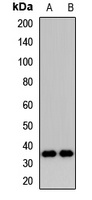 DIMT1 antibody