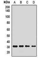 Anti-PLCXD2 Antibody