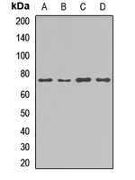 MLXIPL antibody