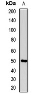 Anti-SHH Antibody
