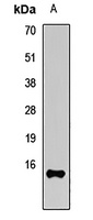 UBE2A antibody