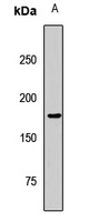 Anti-KDM5B Antibody