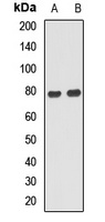 Anti-ANKS1B Antibody