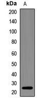 Anti-NDUFS7 Antibody