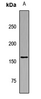 Anti-ARHGEF11 Antibody