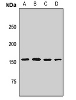 ASCC3 antibody