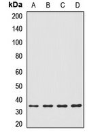 Anti-IL-20RB Antibody