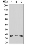 RDH5 antibody