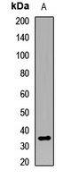 Anti-CNOT8 Antibody