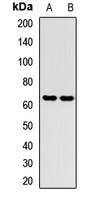 Anti-SETD3 Antibody