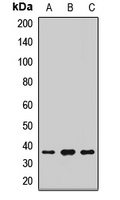 PRPS1 antibody