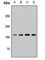 KDM6A antibody
