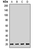 Anti-CD160 Antibody