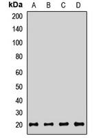 CD160 antibody