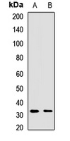 STX12 antibody