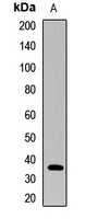 PHF7 antibody