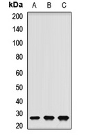 Anti-RNF166 Antibody