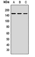 Anti-CD163 Antibody